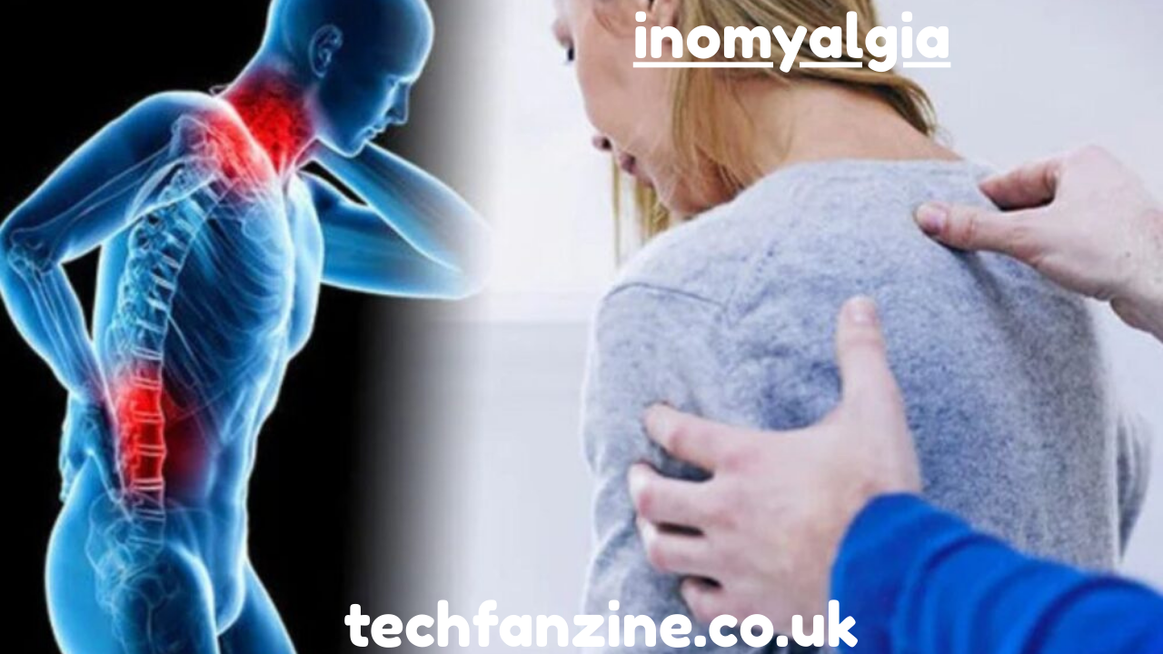 Inomyalgia Understanding, Causes, Symptoms, and Management