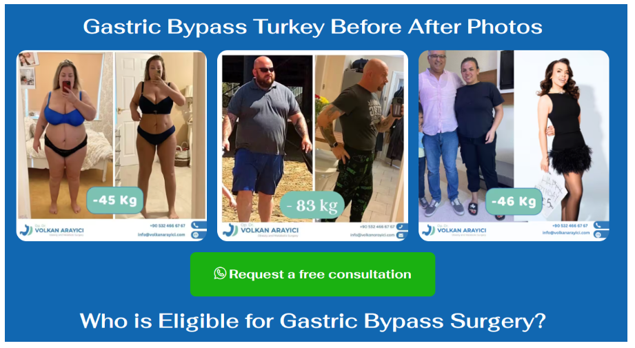 The Benefits of Choosing Turkey for Gastric Sleeve Surgery